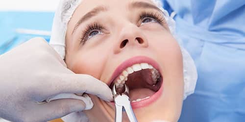 Вырвать зуб у стоматолога