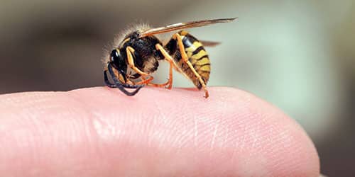 Укус пчелы за палец