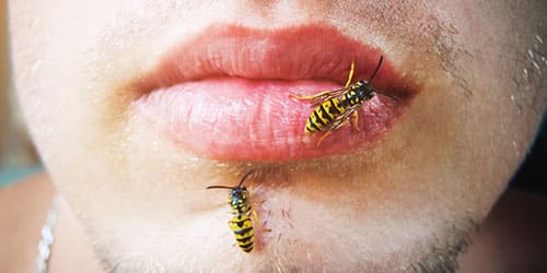 Укус пчелы за губу