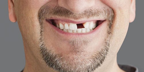 Красивые мужские зубы фото