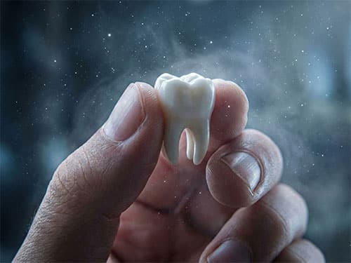 Выпал зуб без крови