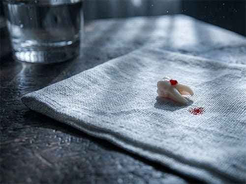 Зуб с кровью